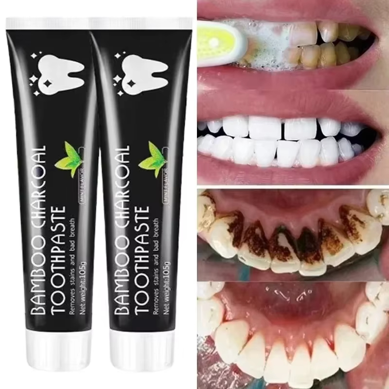 Teeth Whitening Yellow Teeth - Отбеливающая зубная паста Зубная паста с