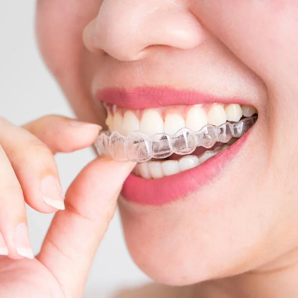 1-4 шт. противоснорковый капп- – обзор и цена Teeth Whitening Mouth Guard