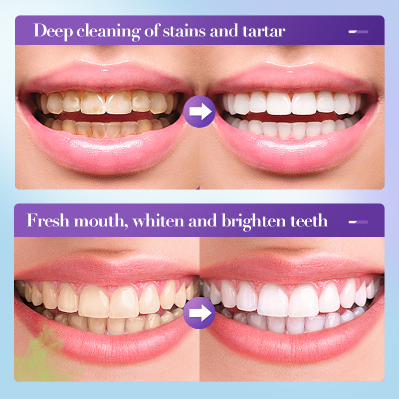 Бестселлер 2026: Отбеливающая  – обзор и цена Teeth Whitening Effective