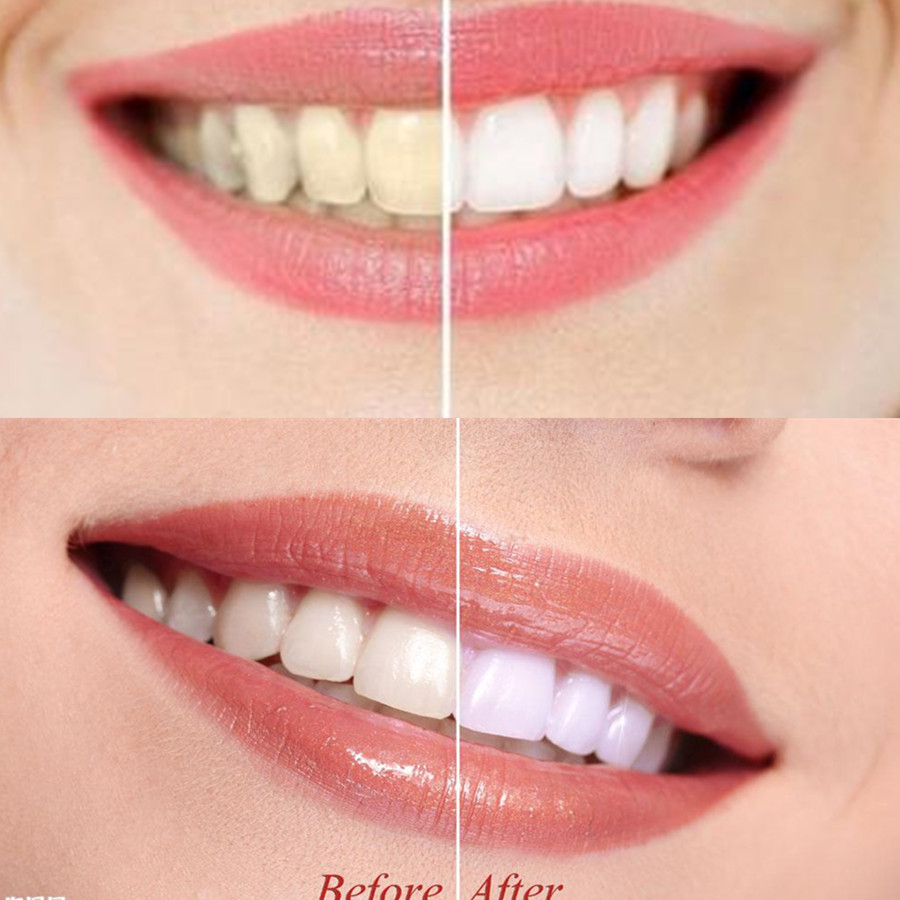 Бамбуковый уголь для зубов, ст – обзор и цена Teeth Whitening Price