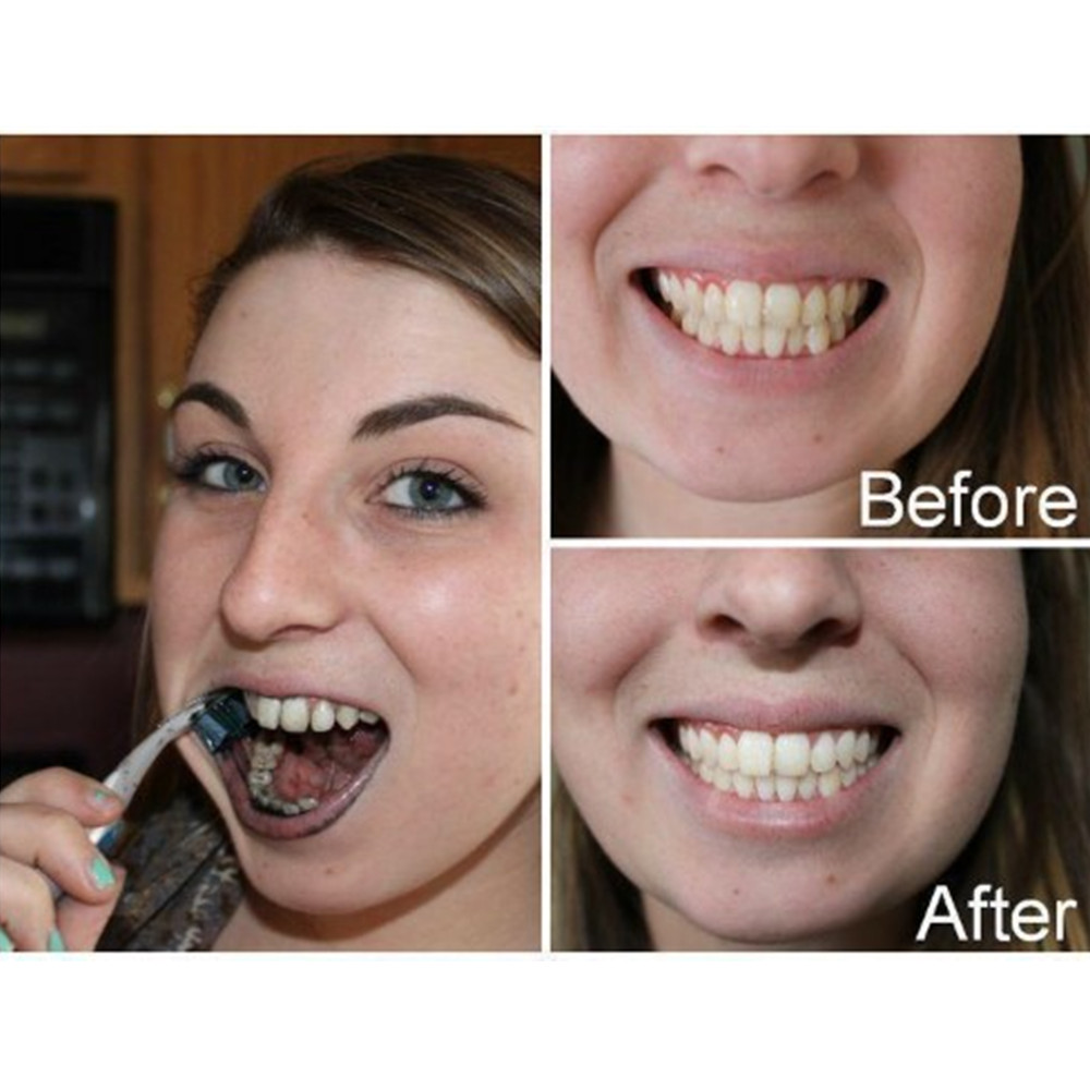 Бамбуковый уголь для зубов, ст – обзор и цена Teeth Whitening Price