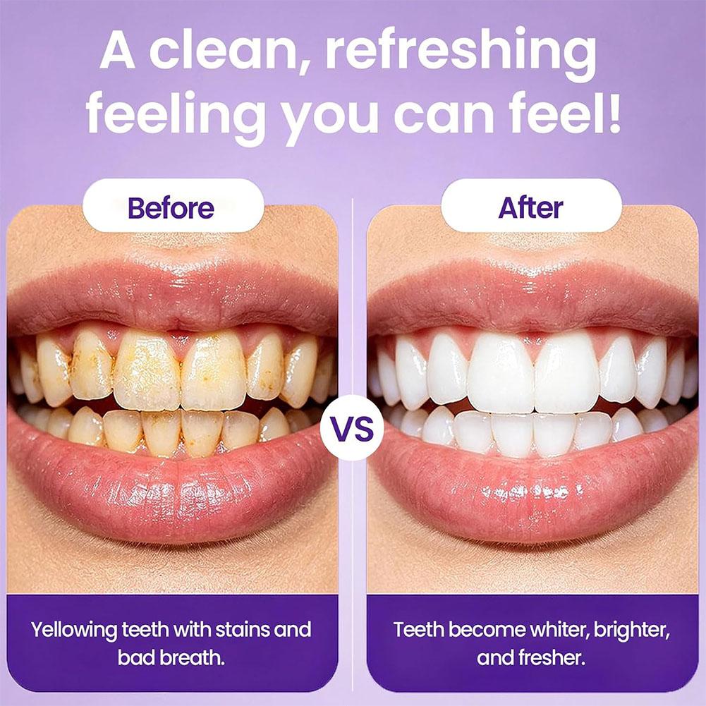 Фиолетовые таблетки для коррек – обзор и цена Teeth Whitening Yellow Teeth