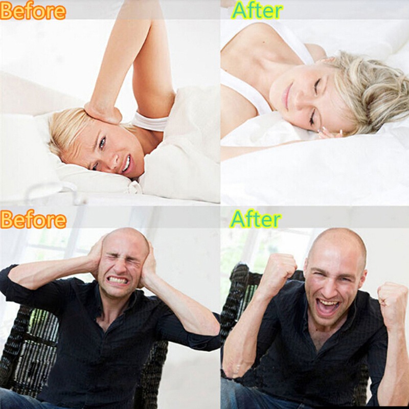 Силиконовая капа для защиты от – обзор и цена Teeth Whitening Mouth Guard