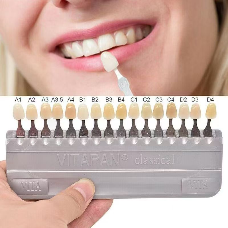 VITA 16-цветная направляющая д – обзор и цена Teeth Whitening Dental