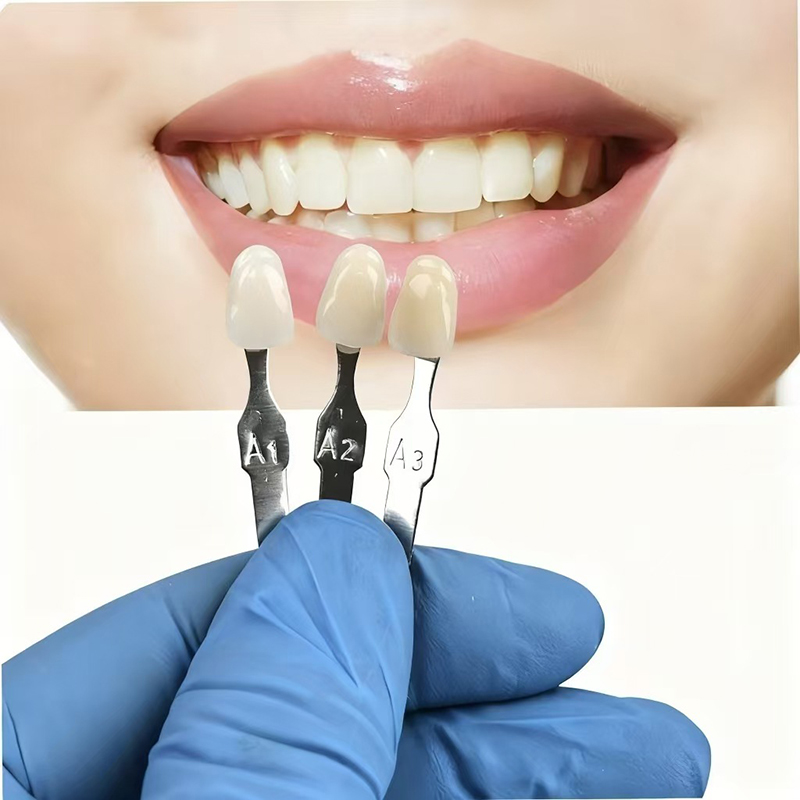 VITA 16-цветная направляющая д – обзор и цена Teeth Whitening Dental