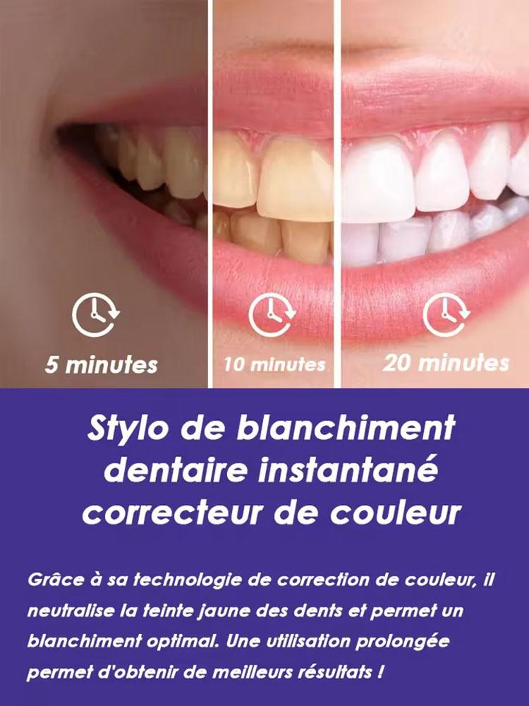 Набор из 2-х гелевых ручек для – обзор и цена Teeth Whitening Effective
