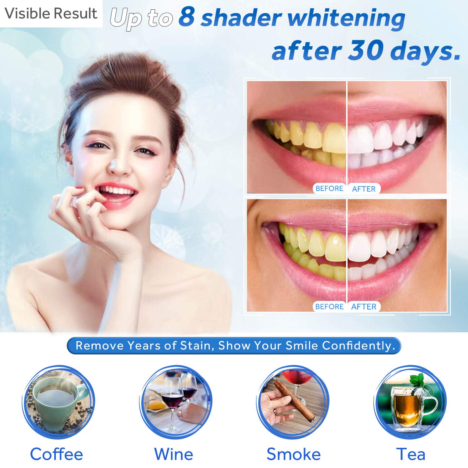 Гель для отбеливания зубов, шп – обзор и цена Teeth Whitening Mouth Guard
