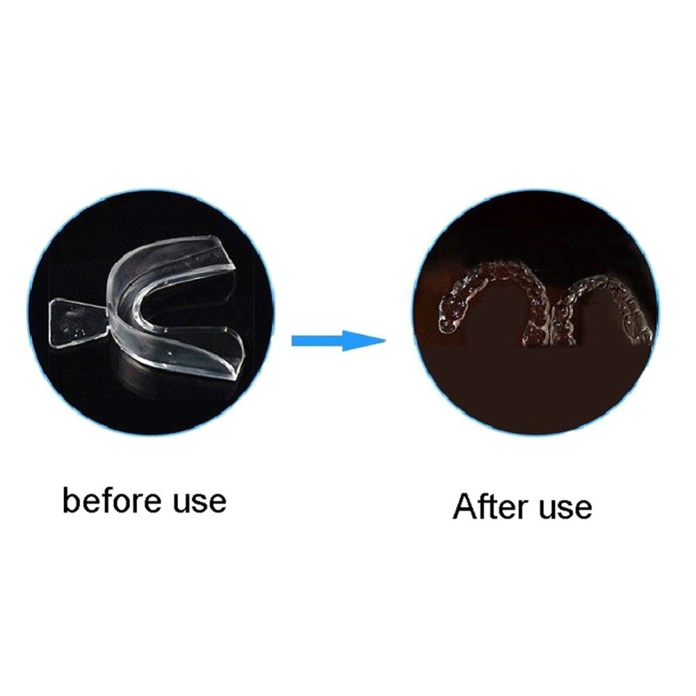 Набор из 2/4 мягких ортодонтич – обзор и цена Teeth Whitening Mouth Guard