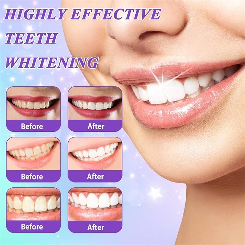 Зубная паста-мусс 9D Purple дл – обзор и цена Teeth Whitening Yellow Teeth