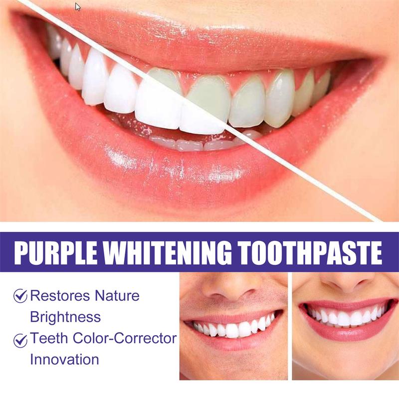 Зубная паста-мусс 9D Purple дл – обзор и цена Teeth Whitening Yellow Teeth
