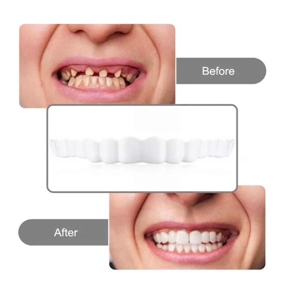 4-6 пар протезов верхней и ниж – обзор и цена Teeth Whitening Mouth Guard
