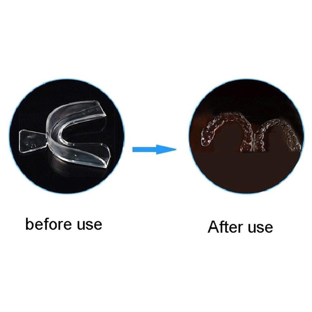 Силиконовая капа-фиксатор для  – обзор и цена Teeth Whitening Mouth Guard