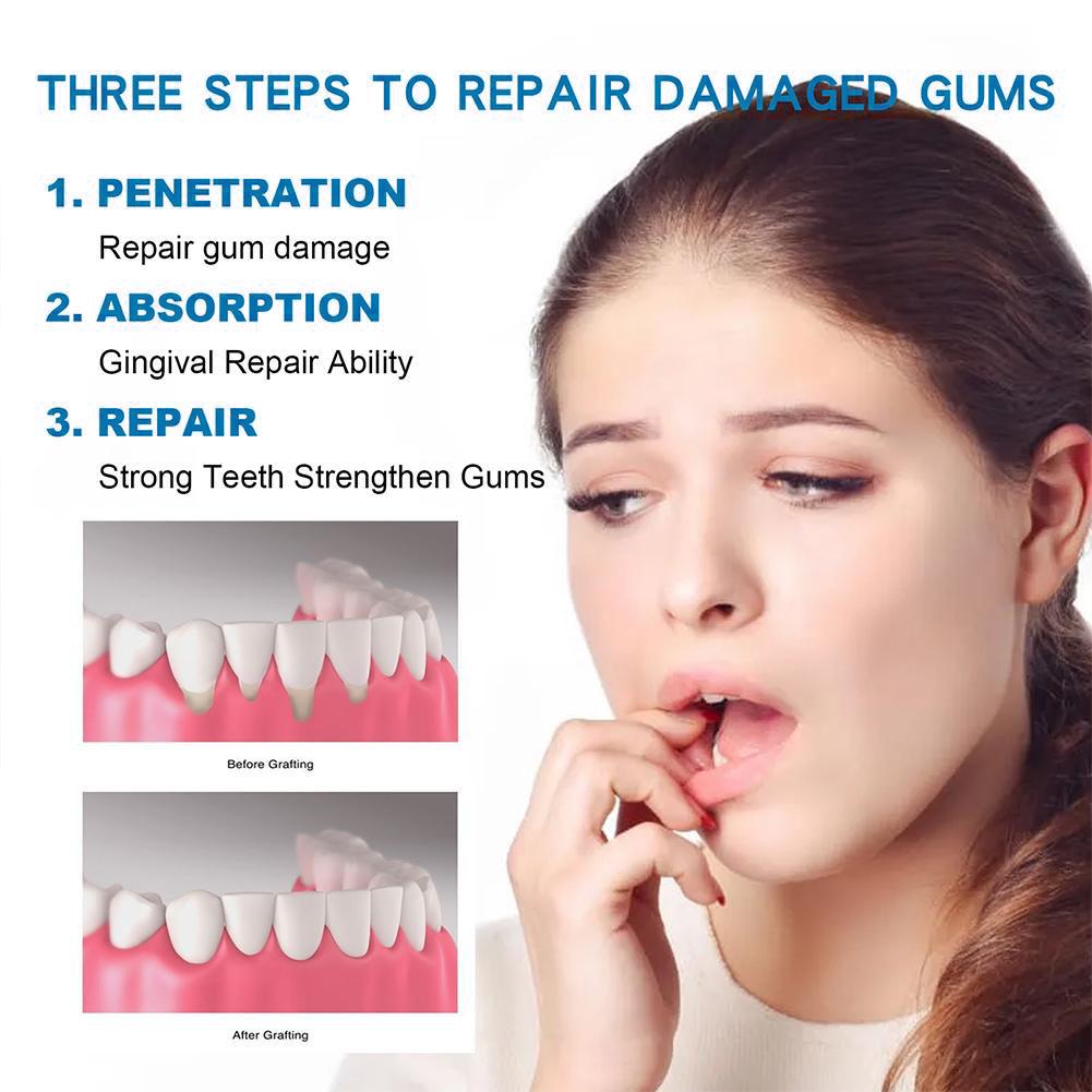 Зубная паста для ухода за поло – обзор и цена Teeth Whitening Best