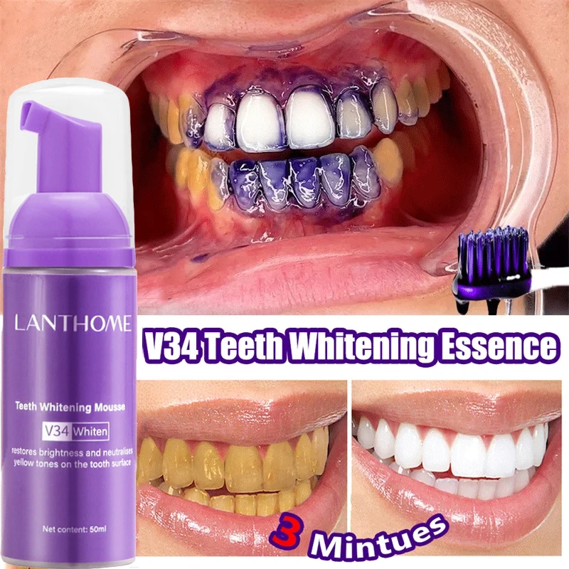 V34 мусс для отбеливания зубов – обзор и цена Teeth Whitening Bleach