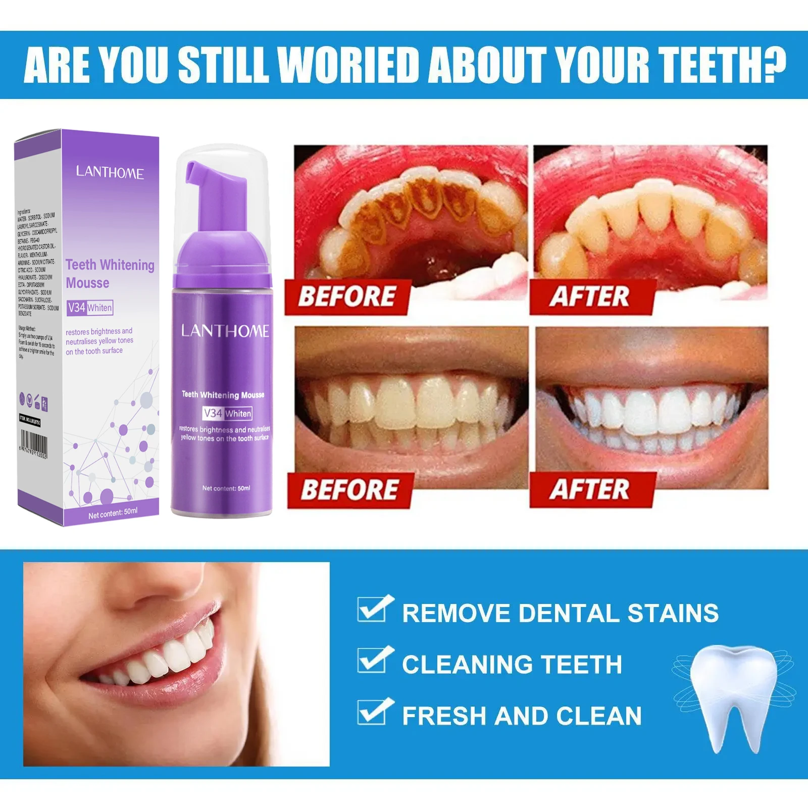 V34 мусс для отбеливания зубов – обзор и цена Teeth Whitening Bleach