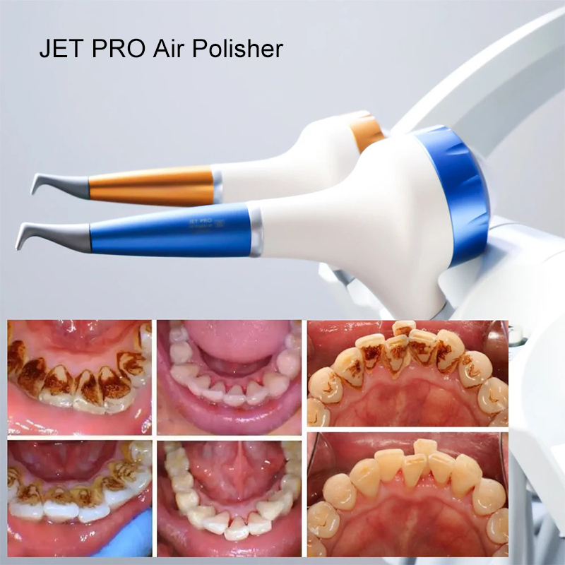 Стоматологический аппарат VV D – обзор и цена Teeth Whitening Dental
