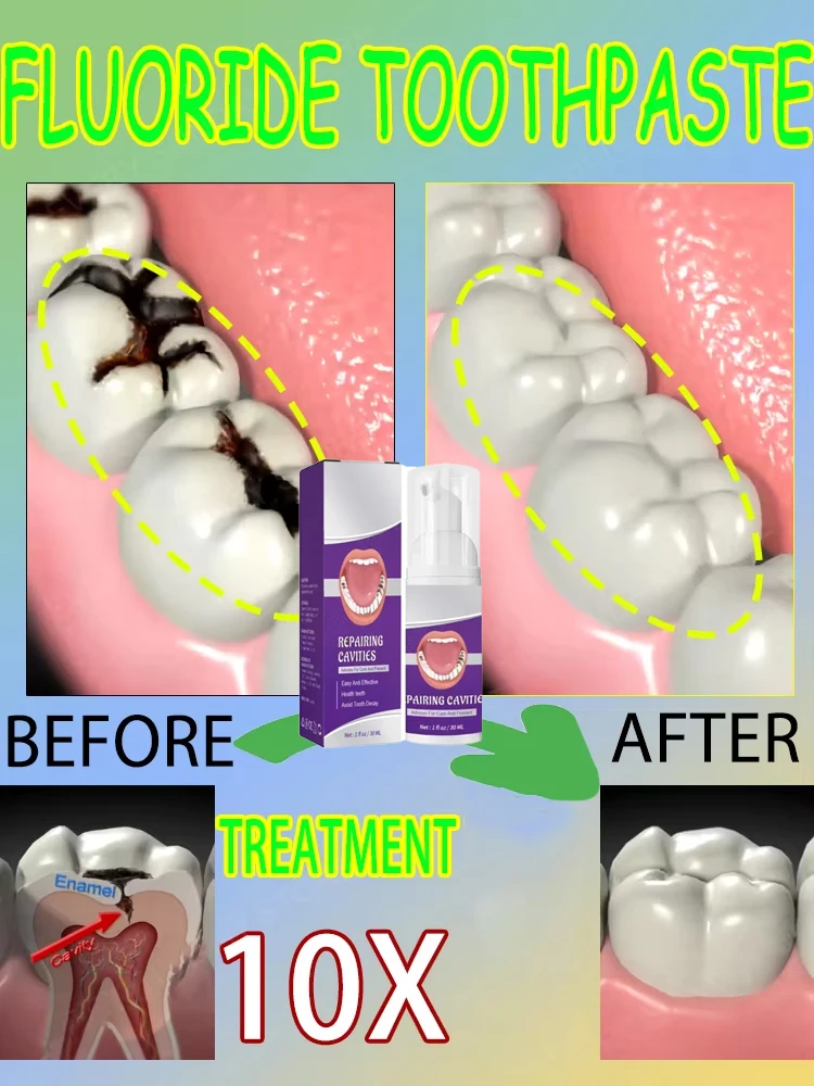 Горячие продажи. Самые продава – обзор и цена Teeth Whitening Best
