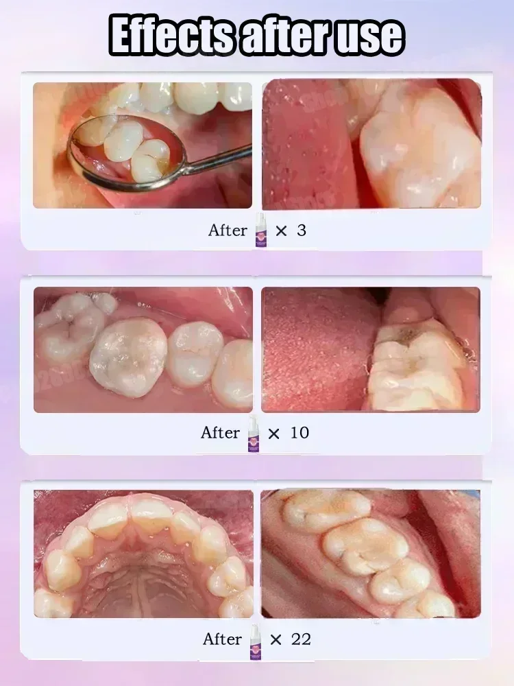 Горячие продажи. Самые продава – обзор и цена Teeth Whitening Best