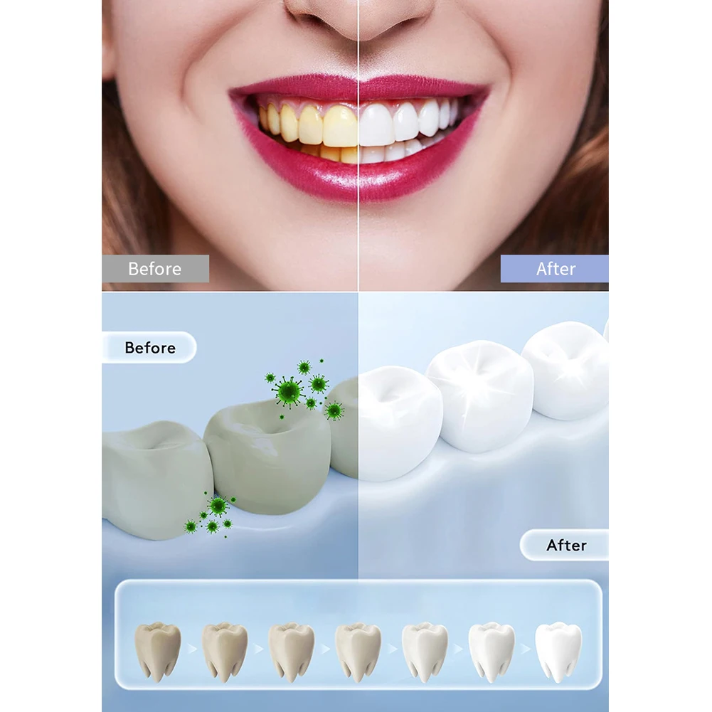1 шт., бытовая умная светодиод – обзор и цена Teeth Whitening Uv