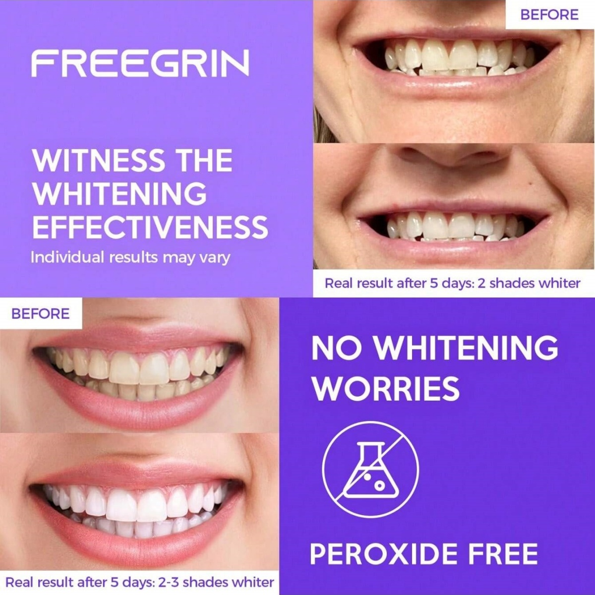 Роскошные отбеливающие наклейк – обзор и цена Teeth Whitening Foam