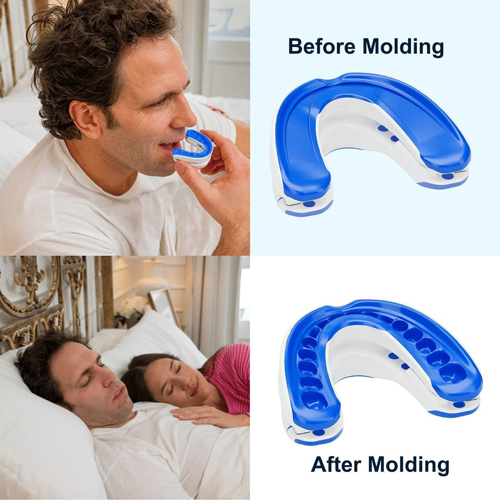 Мундштук против храпа, устройс – обзор и цена Teeth Whitening Mouth Guard
