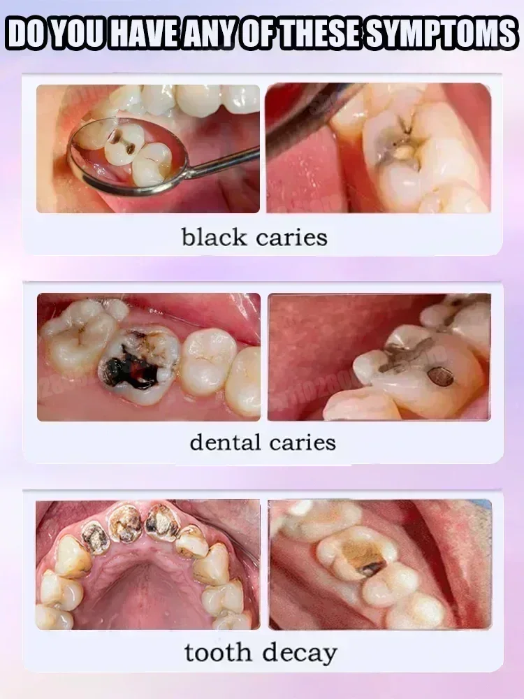 Зубная паста для чистки зубов  – обзор и цена Teeth Whitening Best